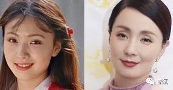 眼窝凹的明星,揭秘眼窝凹明星的独特魅力